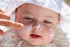 Lindungi Kulit Sejak Dini, Pentingnya Sunscreen untuk Masa Depan yang Cerah