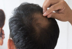 Kebotakan efek Samping dari Penuaan, Ini Beberapa Cara Menumbuhkan Rambut dengan Cepat