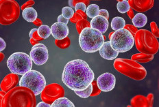 Ayok Kenali Penyebab Leukemia yang Terus Meningkat, Simak Penjelasannya disini
