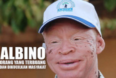 Albino: Kampung Yang Disembunyikan di Afrika