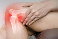 Jangan Sepelekan! Waspada Osteoporosis di Usia Muda