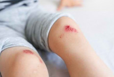 Luka di Kaki Tak Kunjung Sembuh, Jangan Jangan Diabetes! Simak Penjelasannya disini